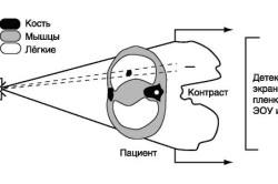 Схема проведения флюорографии