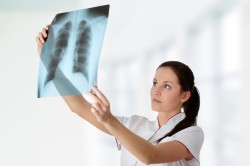 Рентген для оценки состояния легких